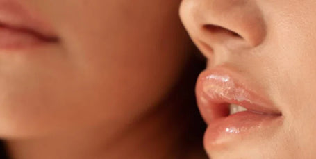 Labios