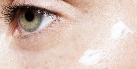 Ojos